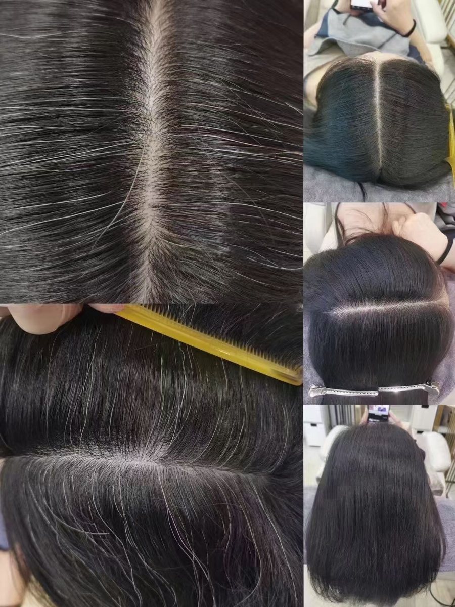 全头多角度前后对比：左侧调理前发缝、发旋白发连成线，右侧调理后发缝收窄、发色趋于一致