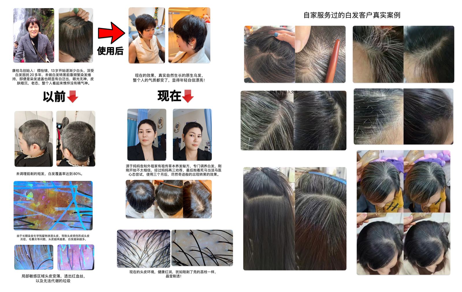 康桂乌·局部调理真实案例对比